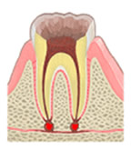 Level.4